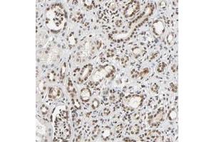 Immunohistochemical staining (Formalin-fixed paraffin-embedded sections) of human kidney with NCOA6 polyclonal antibody  shows nuclear positivity in cells of tubules and glomeruli. (NCOA6 anticorps)