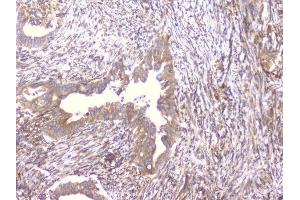 IHC analysis of PCDH15 using anti-PCDH15 antibody (ABIN6719362). (PCDH15 anticorps)