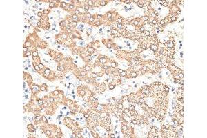 Immunohistochemistry of paraffin-embedded Human liver using KIR3DS1 Polyclonal Antibody at dilution of 1:100 (40x lens). (KIR3DS1 anticorps)