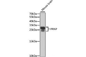 Western blot analysis of extracts of Mouse brain using PRNP Polyclonal Antibody at dilution of 1:1000. (PRNP anticorps)