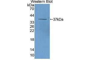 Figure. (ALOX12B anticorps  (AA 389-701))
