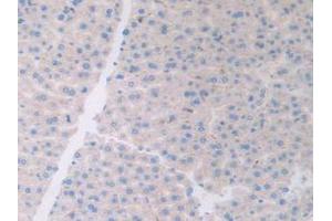 Figure. (ATF6 anticorps  (AA 1-377))