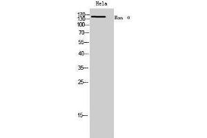 Western Blotting (WB) image for anti-Ron alpha (Internal Region) antibody (ABIN3181449) (Ron alpha (Internal Region) anticorps)