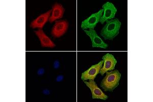 ABIN6257549 and ABIN6276234 staining Hela cells by IF/ICC. (VIPR1 anticorps  (Internal Region))