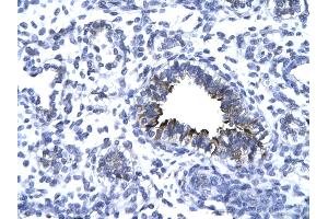 Rabbit Anti-KIF5A antibody   Paraffin Embedded Tissue: Human Lung cell Cellular Data: bronchiole epithelium of renal tubule Antibody Concentration: 4. (KIF5A anticorps  (Middle Region))