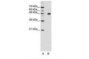 Image no. 1 for anti-PR Domain Containing 12 (PRDM12) (AA 288-337) antibody (ABIN202352) (PRDM12 anticorps  (AA 288-337))