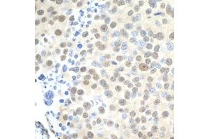 anti-Proline-, Glutamic Acid- and Leucine-Rich Protein 1 (PELP1) (AA 1000-1050) antibody