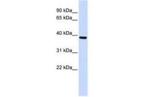 Image no. 1 for anti-F-Box Protein 24 (FBXO24) (AA 304-353) antibody (ABIN6743158) (FBXO24 anticorps  (AA 304-353))