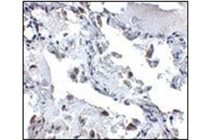 Immunohistochemistry of SH3BP4 in human lung tissue with this product at 5 μg/ml. (SH3BP4 anticorps  (C-Term))