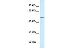 Image no. 1 for anti-Glucokinase (Hexokinase 4) (GCK) (AA 84-133) antibody (ABIN6747601) (GCK anticorps  (AA 84-133))