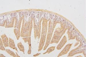 IHC analysis of PRKCD using anti-PRKCD antibody (ABIN7601631).