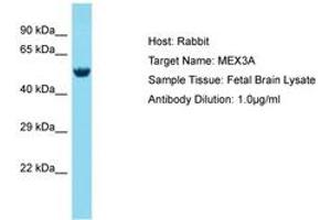 Image no. 1 for anti-Mex-3 Homolog A (MEX3A) (AA 172-221) antibody (ABIN6750731) (MEX3A anticorps  (AA 172-221))