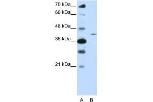 WB Suggested Anti-ZNF488 Antibody Titration:  0. (ZNF488 anticorps  (N-Term))