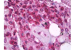 Anti-CD45RO antibody IHC of human spleen, t lymphocytes. (CD45RO anticorps)