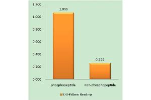 Immunohistochemistry analysis of paraffin-embedded human brain tissue using Ephrin B1/B2 (Phospho-Tyr329) antibody. (Ephrin B1/B2 (pTyr329) anticorps)