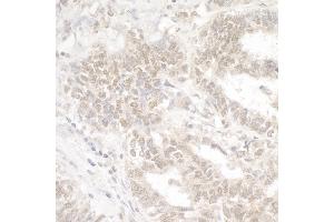 Immunohistochemistry (IHC) image for anti-Ankyrin Repeat-Containing Protein (EHMT2) (C-Term) antibody (ABIN7453554) (EHMT2 anticorps  (C-Term))