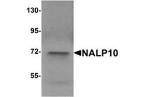 Western blot analysis of NALP10 in human brain tissue lysate with NALP10 antibody at 1 μg/ml.
