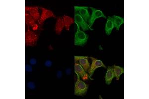 ABIN6261041 and ABIN6272826 staining Hela cells by IF/ICC. (CRMP1 anticorps  (C-Term))