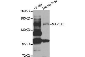 Western blot analysis of extracts of various cell lines, using MAP3K5 antibody. (ASK1 anticorps  (AA 1175-1374))