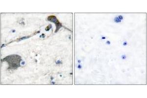 Immunohistochemistry analysis of paraffin-embedded human brain tissue, using RASH/RASK Antibody. (RASH/RASK (AA 1-50) anticorps)