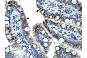 Immunohistochemical staining (Formalin-fixed paraffin-embedded sections) of human intestine with KRT15 polyclonal antibody .