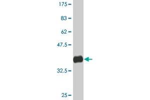 Western Blot detection against Immunogen (36. (CHD4 anticorps  (AA 1632-1730))