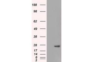Western Blotting (WB) image for anti-Adenylate Kinase 1 (AK1) antibody (ABIN1496517) (Adenylate Kinase 1 anticorps)