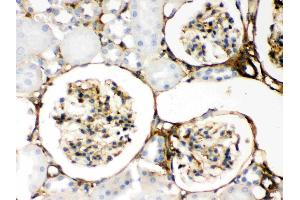 Galectin 1 was detected in paraffin-embedded sections of rat kidney tissues using rabbit anti- Galectin 1 Antigen Affinity purified polyclonal antibody (Catalog # ) at 1 µg/mL.