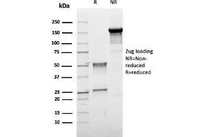 SDS-PAGE Analysis Purified ER-beta Mouse Monoclonal Antibody (ESR2/3005). (ESR2 anticorps)