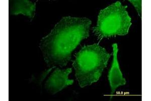 Image no. 2 for anti-Hematopoietic Cell-Specific Lyn Substrate 1 (HCLS1) (AA 266-356) antibody (ABIN598726) (HCLS1 anticorps  (AA 266-356))
