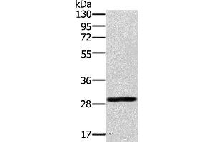 Western blot analysis of 293T cell, using EDA2R Polyclonal Antibody at dilution of 1:450 (Ectodysplasin A2 Receptor anticorps)