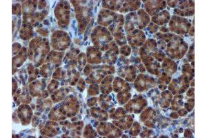 anti-Metalloproteinase Inhibitor 2 (TIMP2) antibody