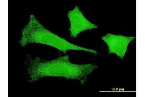 Immunofluorescence of monoclonal antibody to FBXO4 on HeLa cell.
