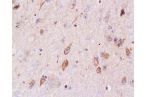 Formalin-fixed and paraffin embedded rabbit brain tissue labeled with Anti-Bax Polyclonal Antibody, Unconjugated  at 1:200 followed by conjugation to the secondary antibody and DAB staining