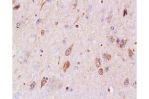 Immunohistochemistry (Paraffin-embedded Sections) (IHC (p)) image for anti-BCL2-Associated X Protein (BAX) (AA 84-175) antibody (ABIN725390)