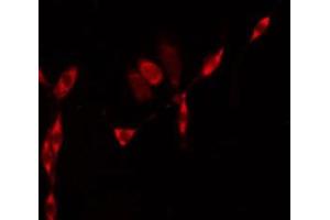 ABIN6275583 staining Hela by IF/ICC.