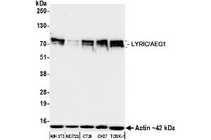 Western Blotting (WB) image for anti-Metadherin (MTDH) (AA 475-525) antibody (ABIN7795651)