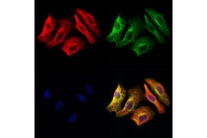 ABIN6262752 and ABIN6278170 staining Hela cells by IF/ICC. (KCNJ2 anticorps  (C-Term))