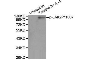Western Blotting (WB) image for anti-Janus Kinase 2 (JAK2) (pTyr1007) antibody (ABIN3020271) (JAK2 anticorps  (pTyr1007))