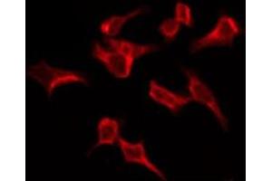 ABIN6276149 staining HeLa by IF/ICC. (OR4C6 anticorps  (Internal Region))