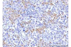 IHC analysis of PTPIP51/RMDN3 using anti-PTPIP51/RMDN3 antibody (ABIN7601775). (RMDN3 anticorps  (AA 45-438))