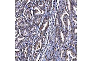IHC analysis of Scavenging Receptor SRB2/SCARB2 using anti-Scavenging Receptor SRB2/SCARB2 antibody (ABIN7601833).