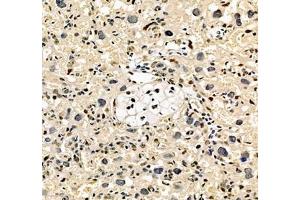 Immunohistochemistry of paraffin embedded rat placenta using notch3 (ABIN7074862) at dilution of 1:700 (250x lens) (NOTCH3 anticorps)