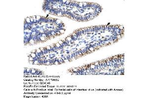 Human Intestine (KLHL13 anticorps  (N-Term))
