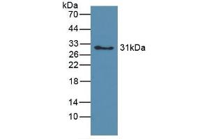 Detection of Recombinant hemoglobin, Canine using Polyclonal Antibody to Hemoglobin (HB) (Hemoglobin anticorps)