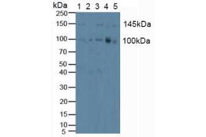 Figure. (PKC mu anticorps  (AA 651-876))