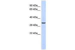 WB Suggested Anti-Vax1 Antibody Titration:  0. (VAX1 anticorps  (N-Term))