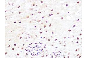 Immunohistochemistry of paraffin-embedded human esophageal using JunB Rabbit mAb (ABIN7268048) at dilution of 1:100 (40x lens). (JunB anticorps)