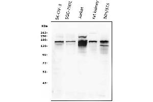 Western blot analysis of KAT13A/SRC1 using anti-KAT13A/SRC1 antibody (ABIN3042385). (NCOA1 anticorps  (AA 614-826))
