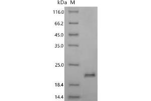 (Tris-Glycine gel) Discontinuous SDS-PAGE (reduced) with 5 % enrichment gel and 15 % separation gel.
